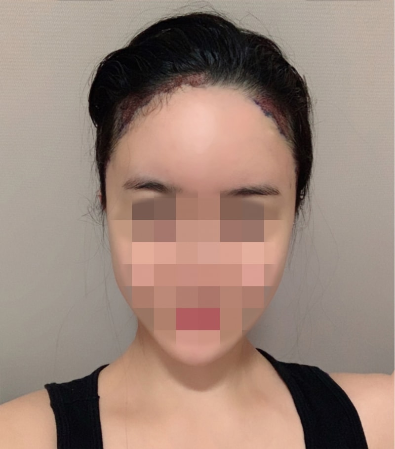 수술당일01.jpg