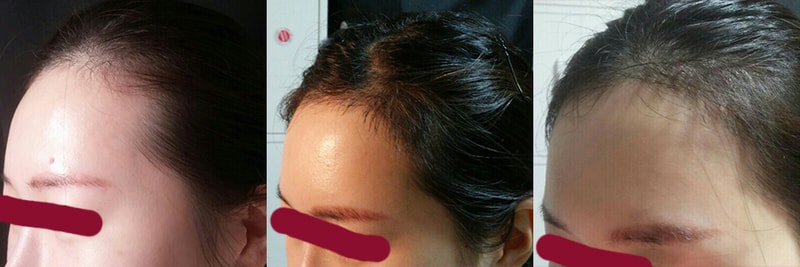 왼쪽.jpg