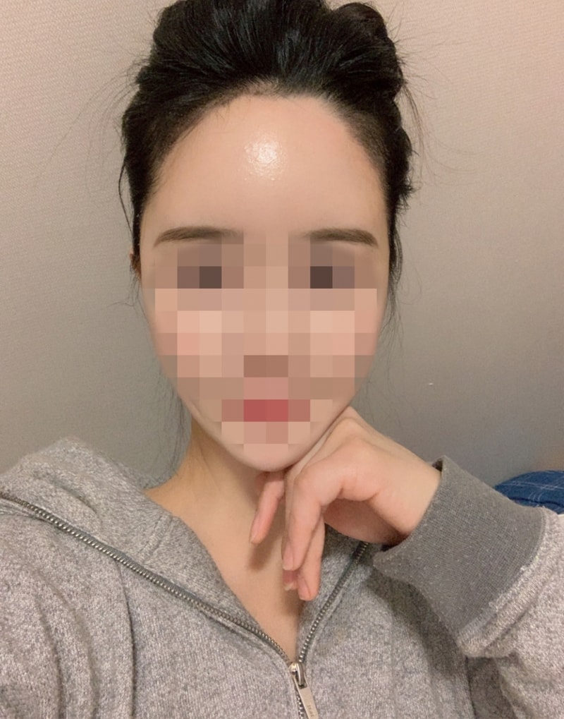 수술일주일02.jpg