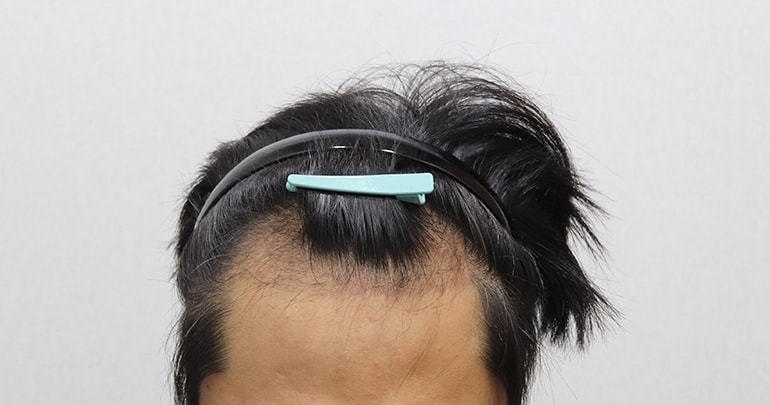 4암흑기.JPG