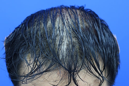 포토후기 이미지