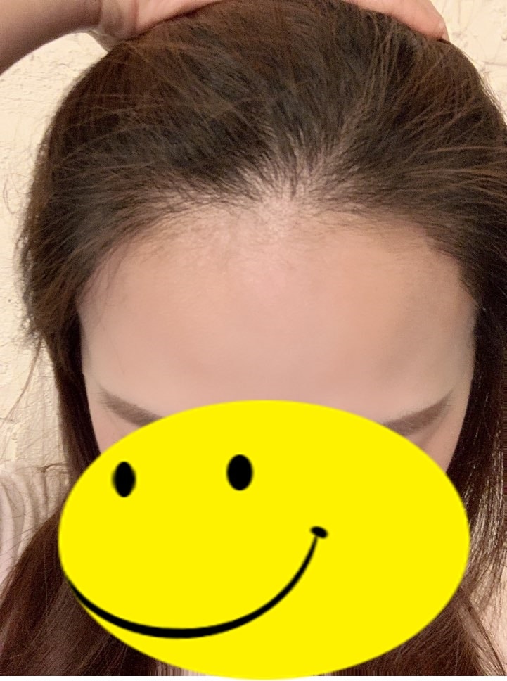 7번.jpg