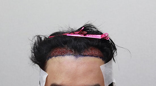2.JPG