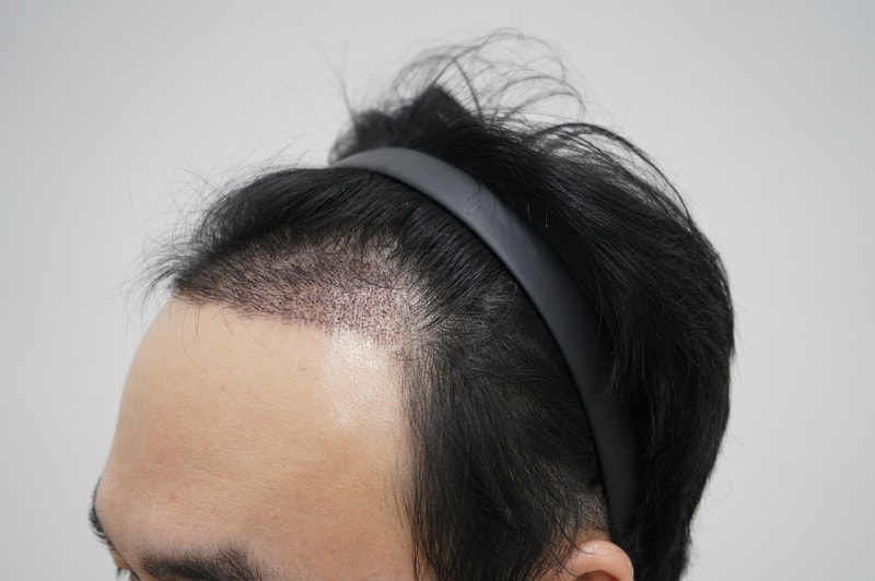 모아트 의원 3주차 후기 입니다