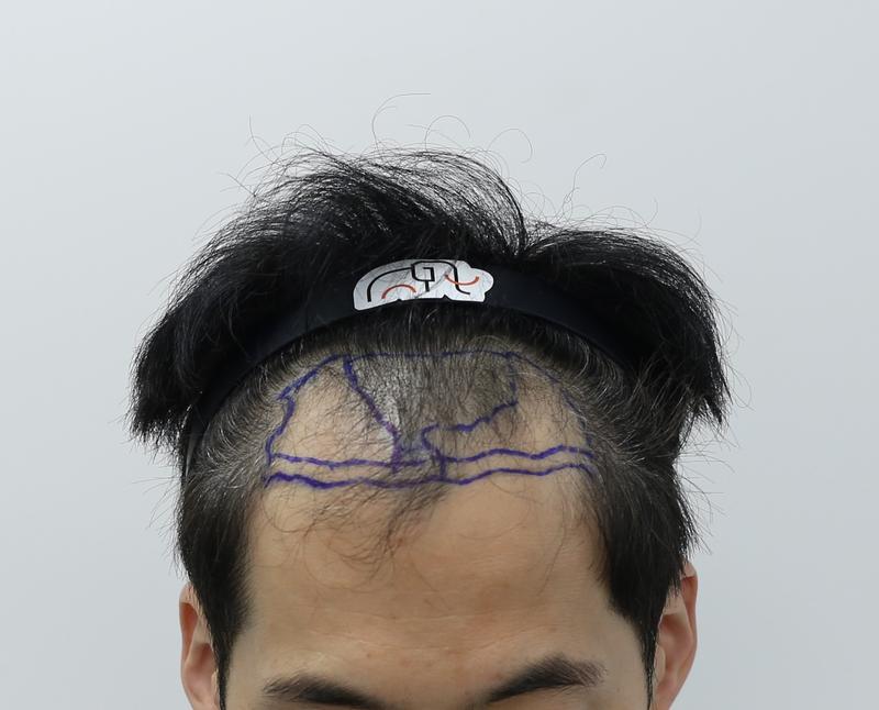 1000009341.jpg