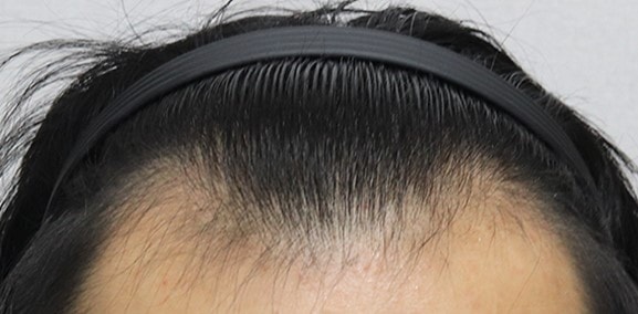 수술 전.jpg