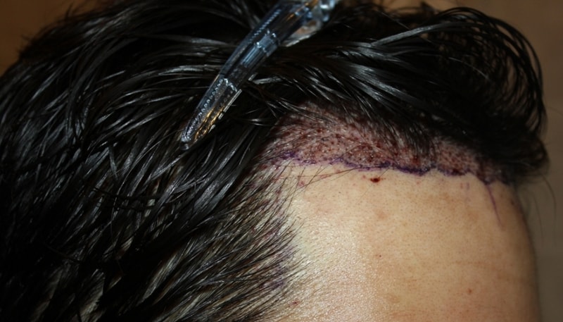surgery2.jpg