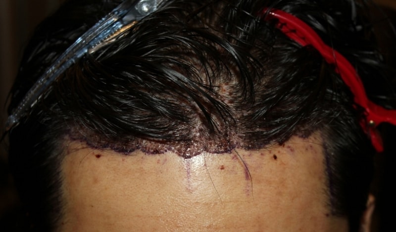surgery3.jpg