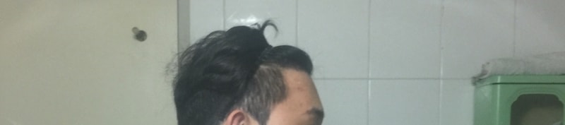 좌측.jpg