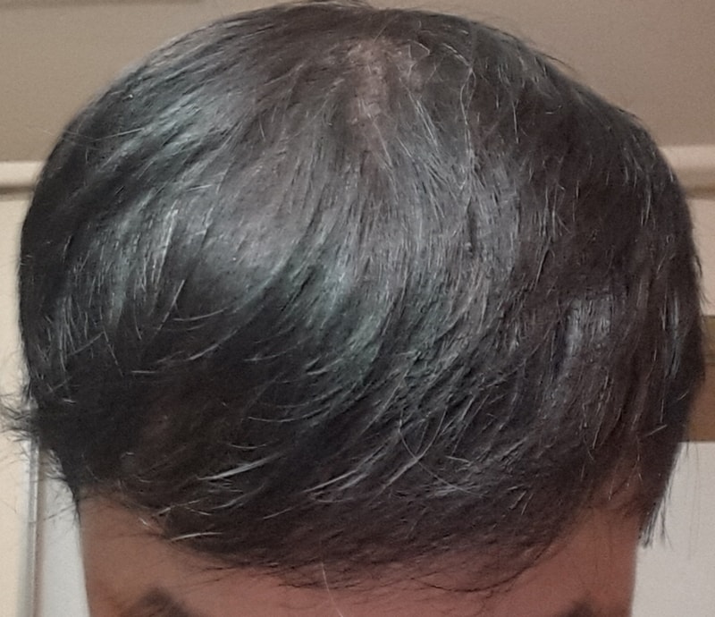 op20150809_083830.jpg