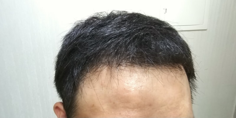 20180820_222001.jpg