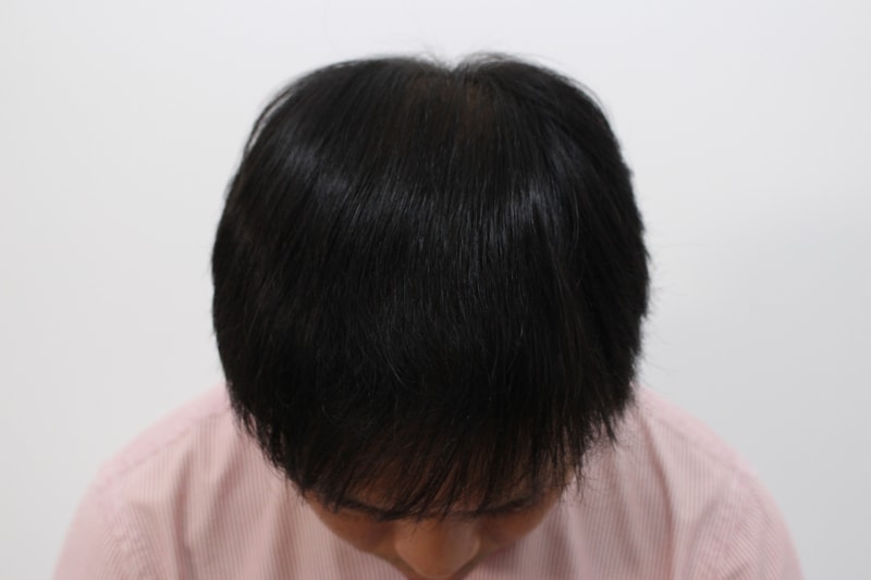 수술후_위.jpg