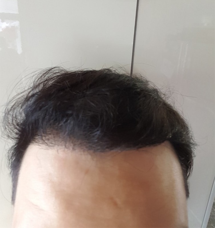 6.7개월후.jpg