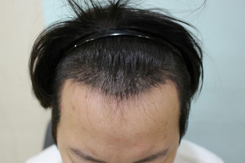 KakaoTalk_20180410_001311557.jpg