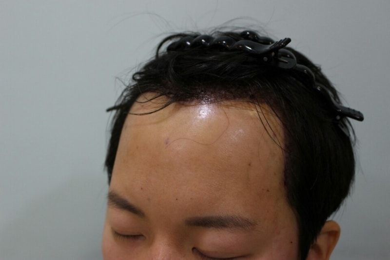 KakaoTalk_20180401_235854772.jpg