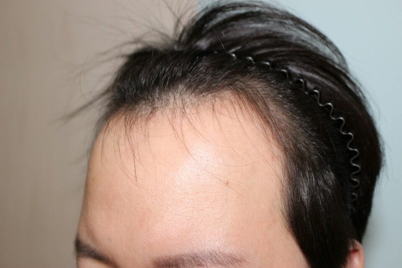 KakaoTalk_20180401_235852619.jpg