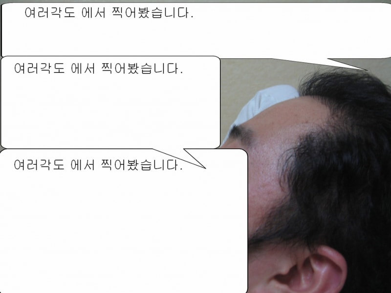 얼굴가리기7.jpg