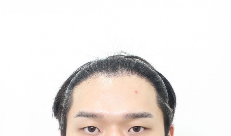 앞.jpg