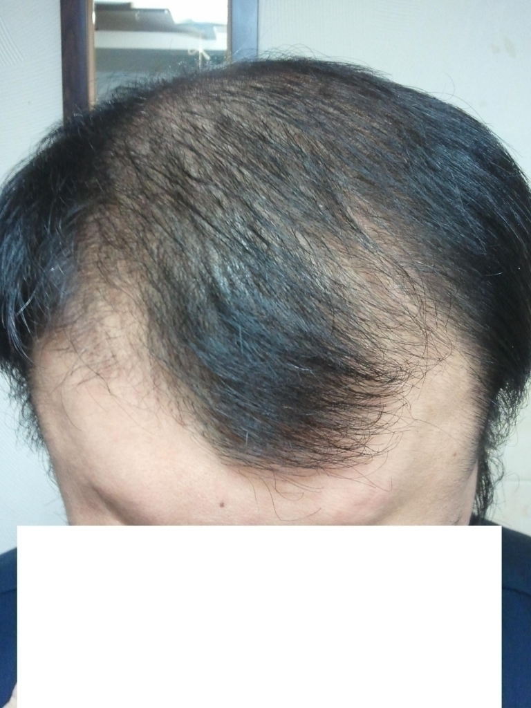 105일 정면.jpg