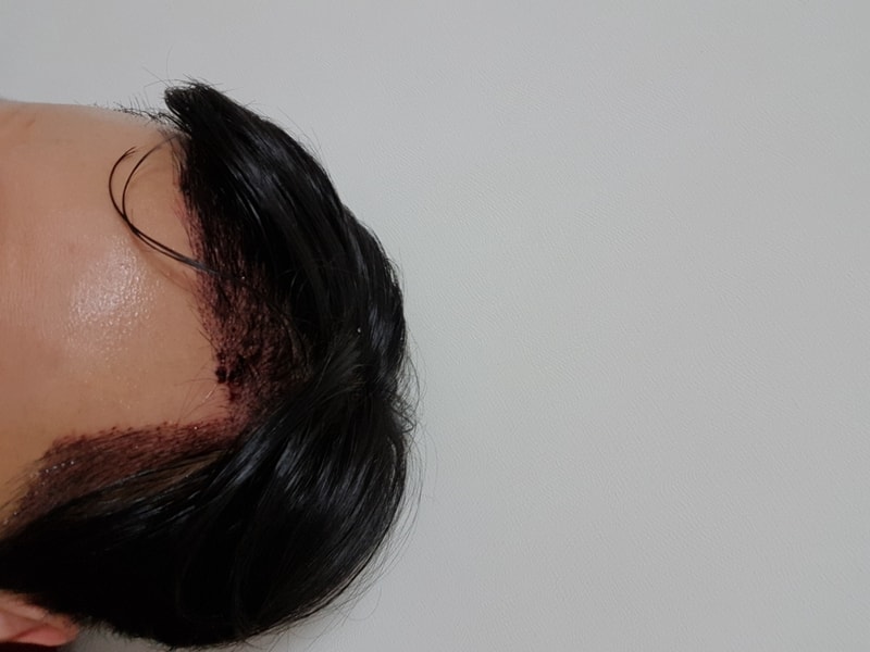 20180623_172441.jpg