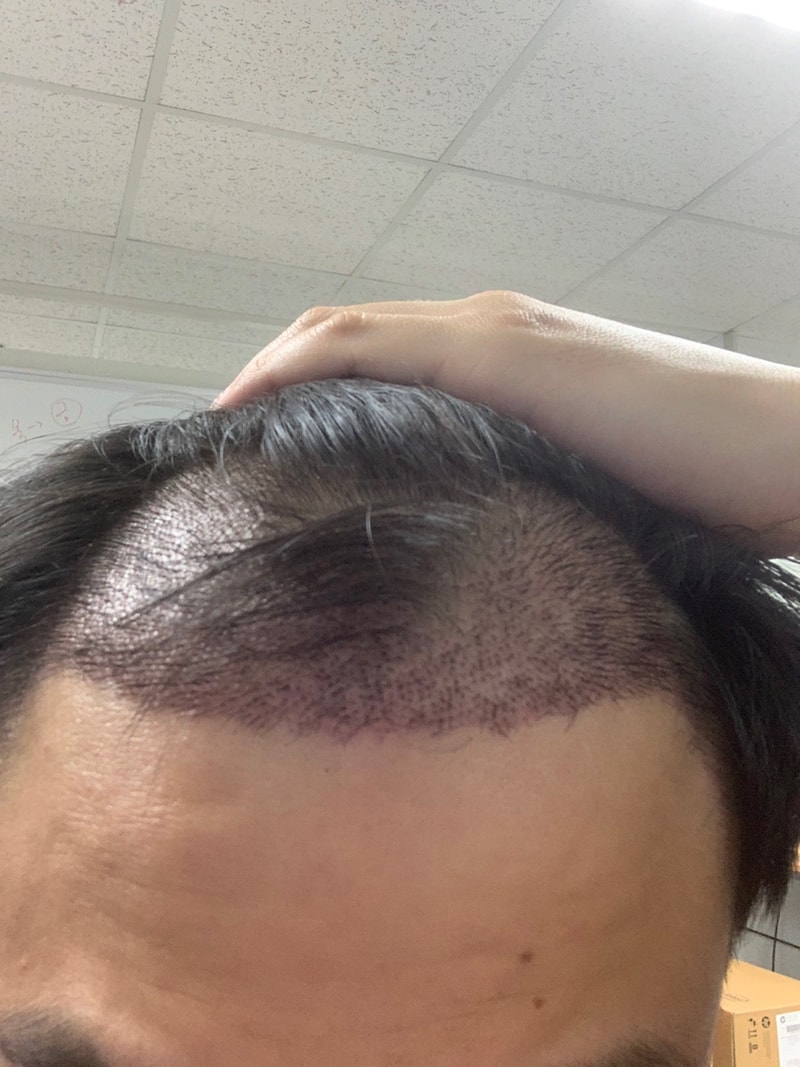 大工事15日目