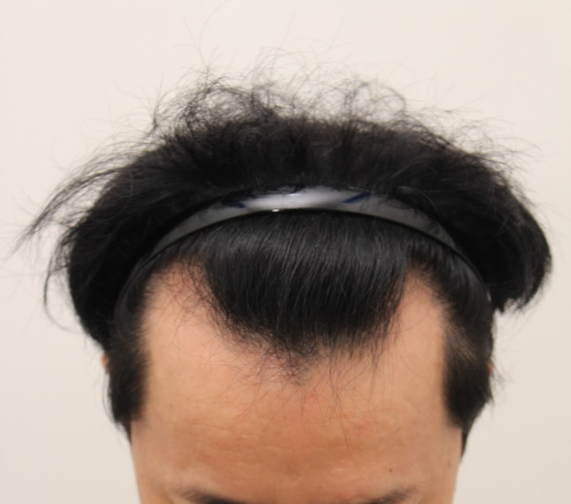 长出了细毛