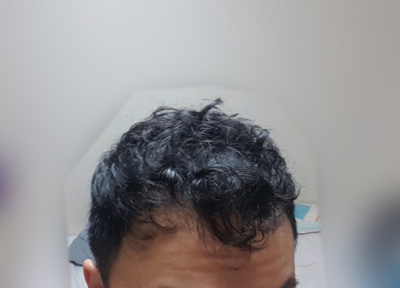 三个月后记。  现在不撒黑菜了。