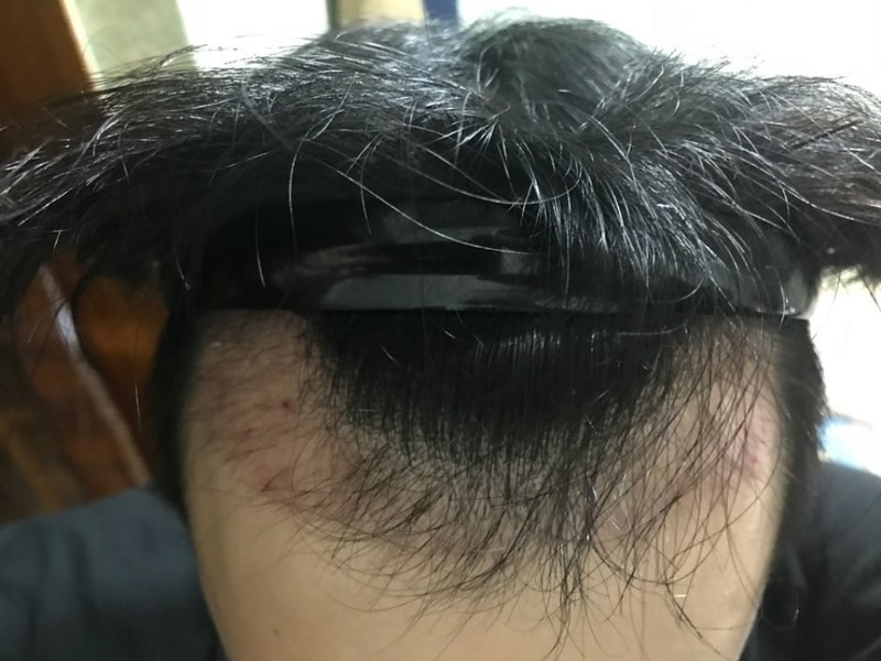 KakaoTalk_20180314_004944033.jpg