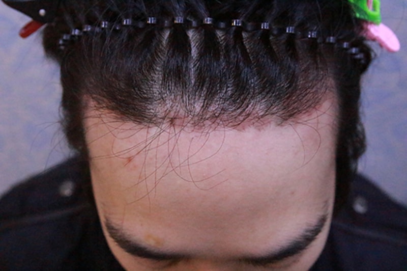 1달경과좀안됨_2.jpg