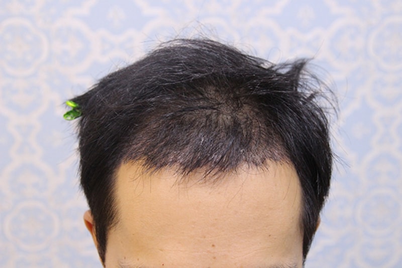실밥제거_01.jpg
