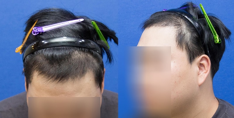 101일경과.jpg