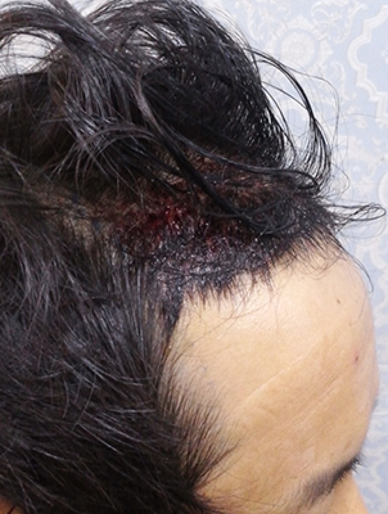 수술후2.jpg