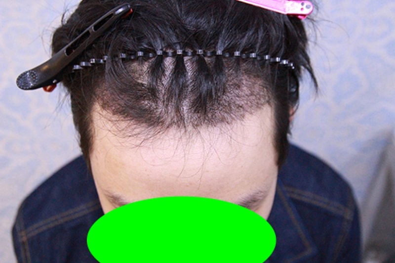 1차실밥제거.jpg