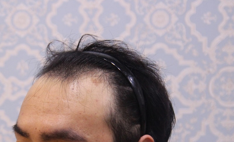 수술전2.jpg