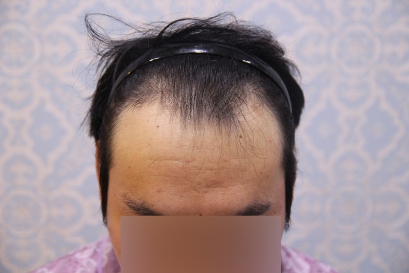 수술전1.jpg
