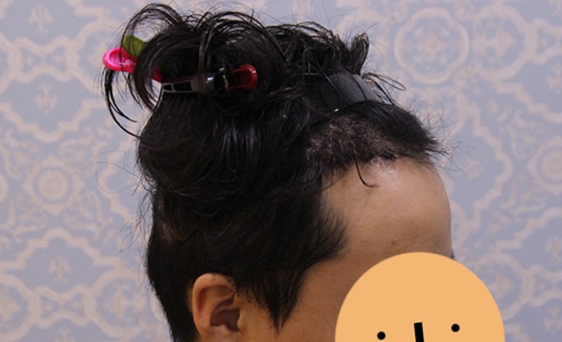 수술후03.jpg