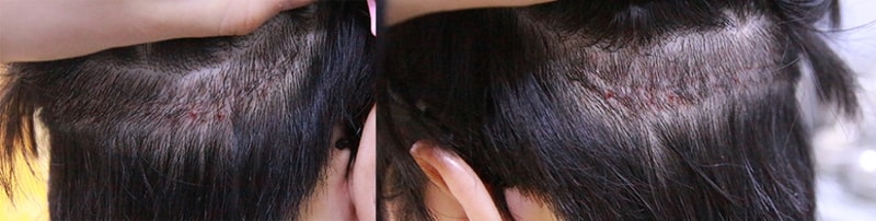 2차실밥제거2].jpg