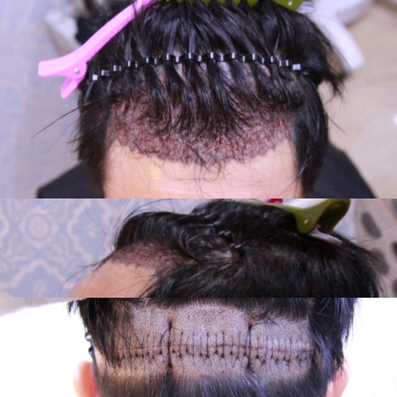수술후.jpg