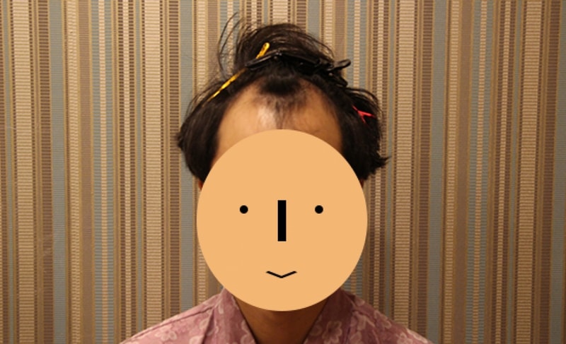 수술전.jpg