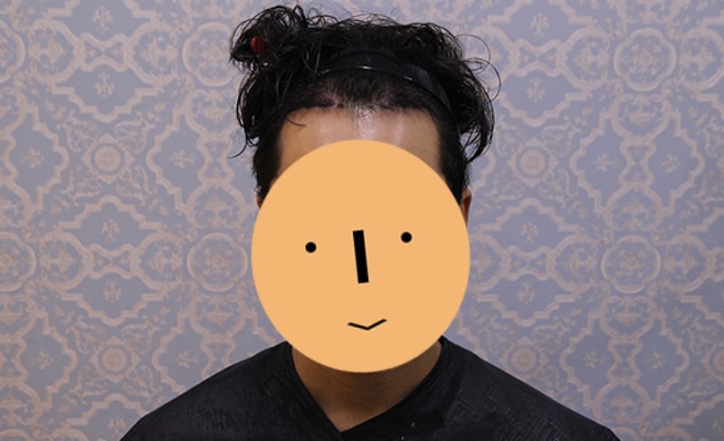수술후02.jpg