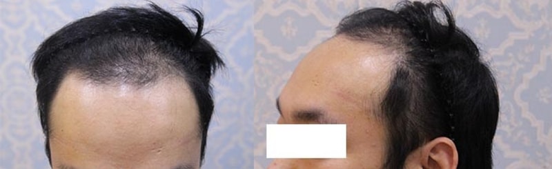 수술전.jpg