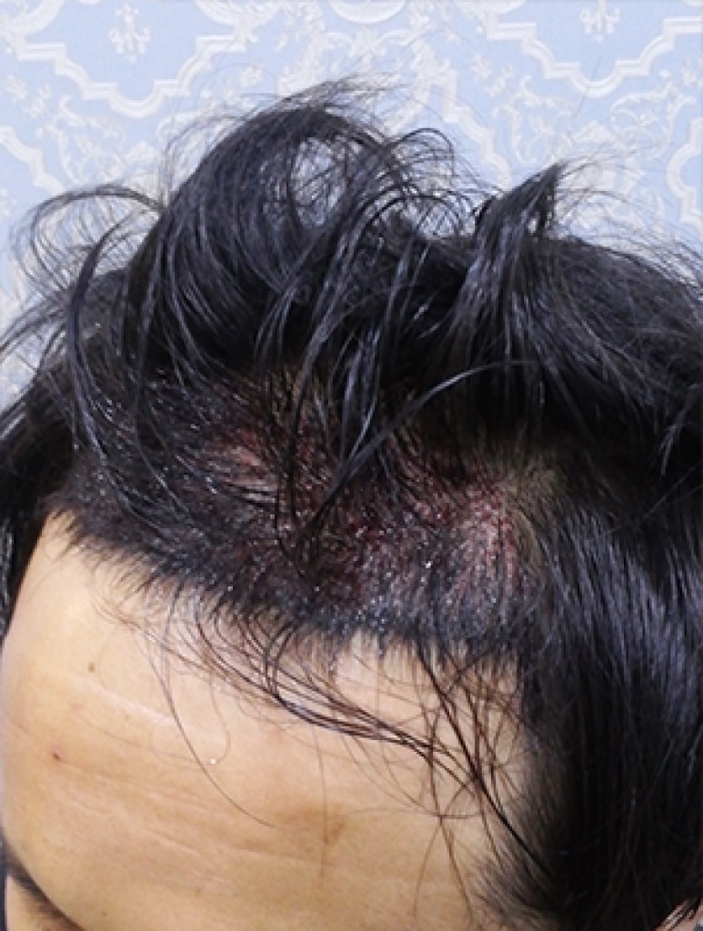 수술후.jpg