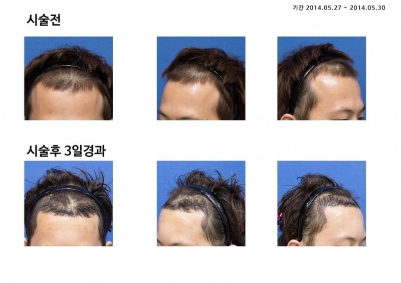 포스팅.jpg