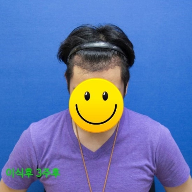 3주.jpg