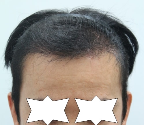 수술후.jpg
