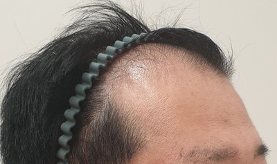 수술전.jpg