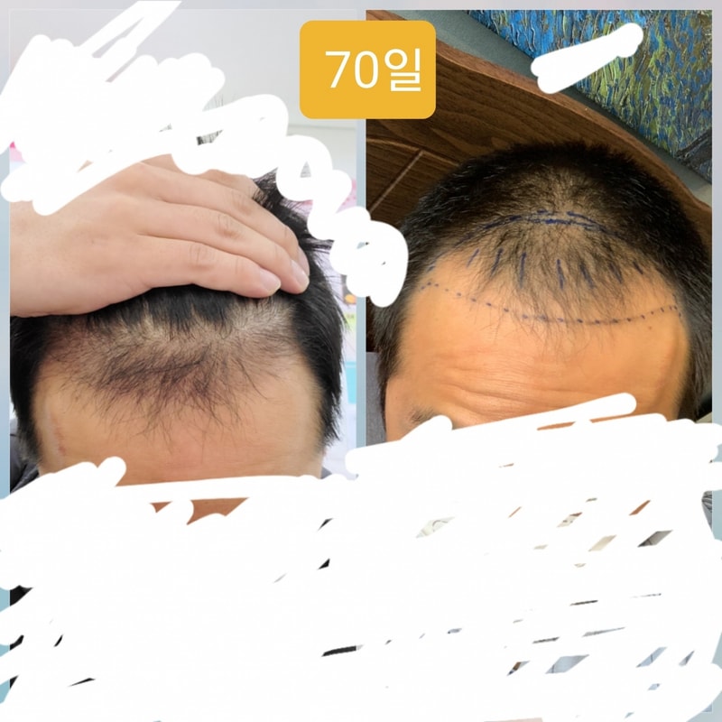 벌써 1년이 지났네요
