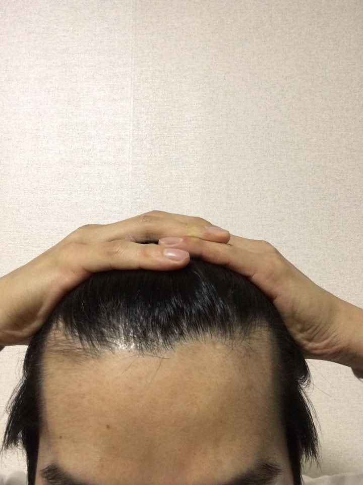 비포.jpg