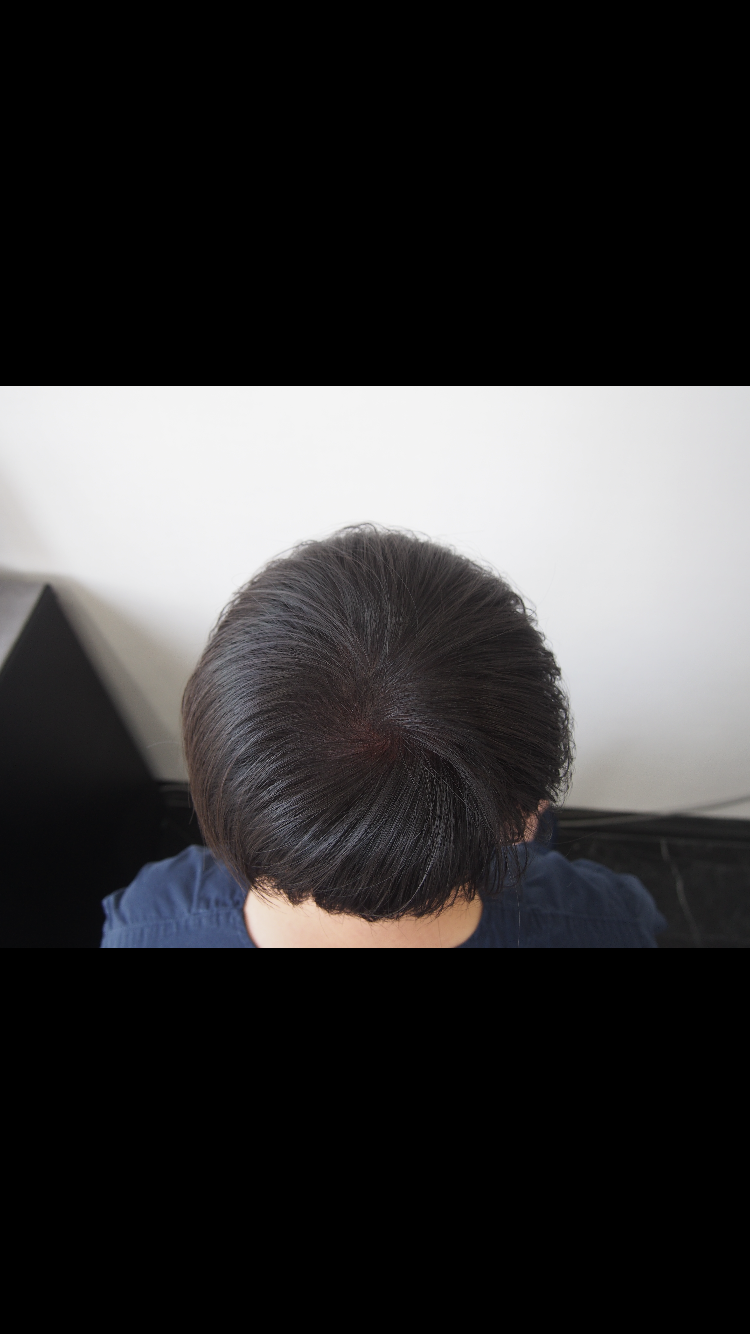 87776139-F07F-4D9A-9850-14549CF43005.png