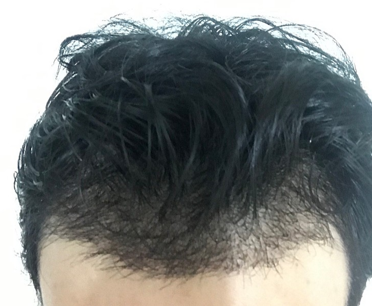15일차   ㅇㅇ.PNG